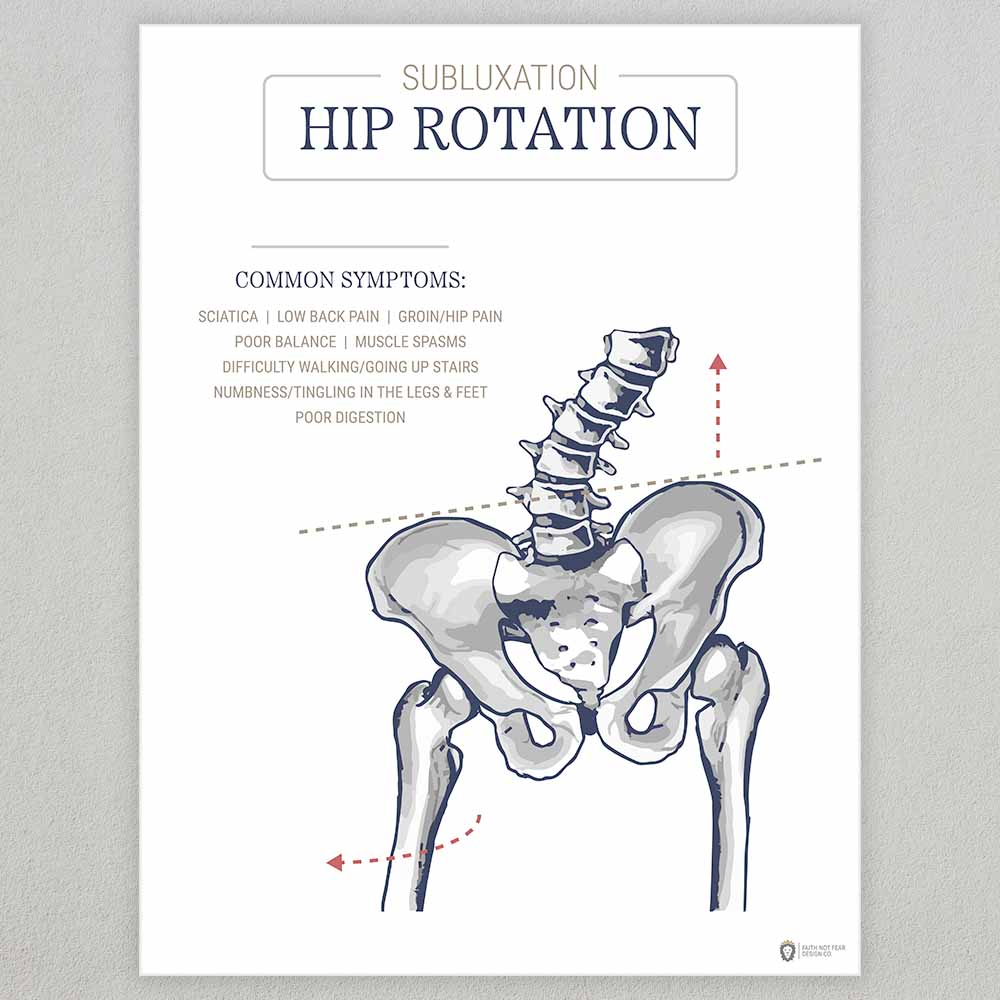 subluxation-hip-rotation