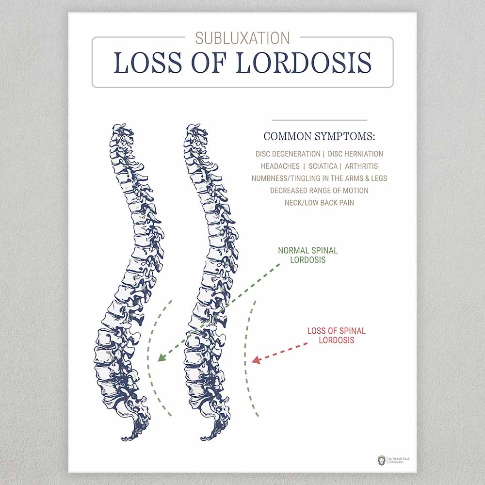 subluxation-loss-of-lordosis