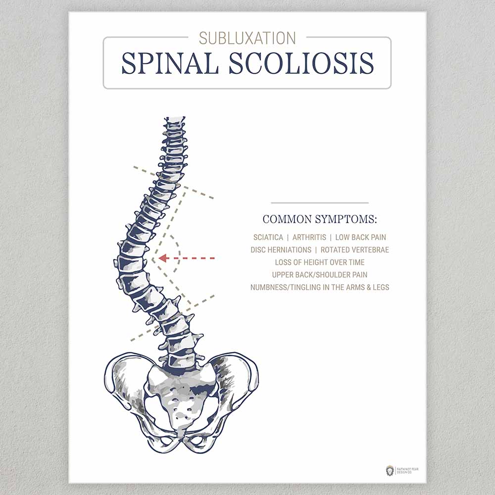 subluxation-spinal-scoliosis