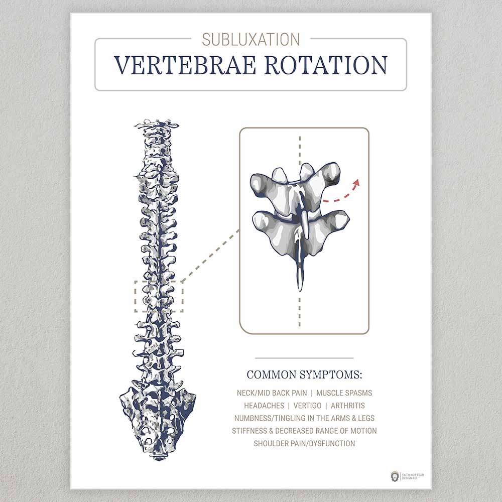subluxation-vertebrae-rotation